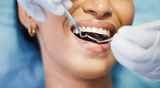 Best Broken or Cracked Tooth Emergency Dentist in Passaic, NJ